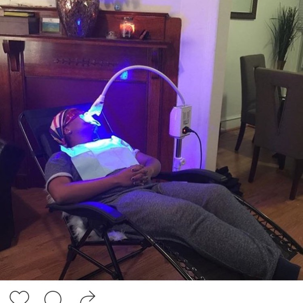 Teeth whitening kits - Picture 5 of 5